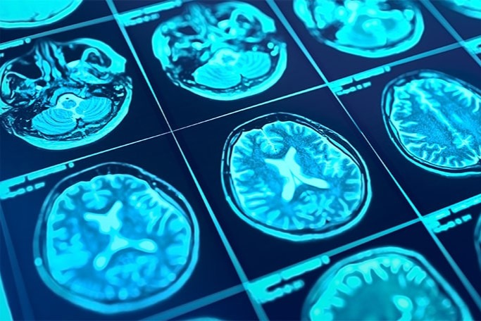 AI in Medical Imaging: How It Transforms Diagnostics